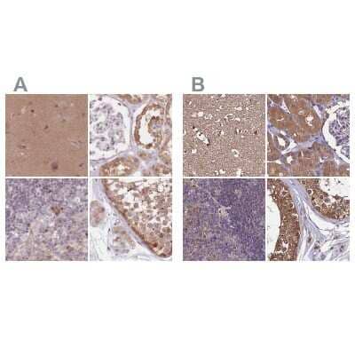 Immunohistochemistry-Paraffin APOA1BP Antibody