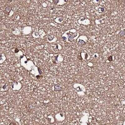 Immunohistochemistry-Paraffin: APOA1BP Antibody [NBP2-30943] - Staining of human cerebral cortex.