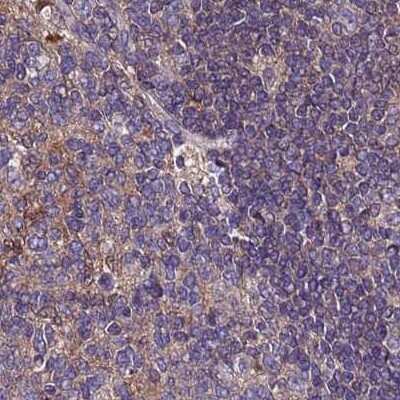 Immunohistochemistry-Paraffin: APOA1BP Antibody [NBP2-30943] - Staining of human lymph node.