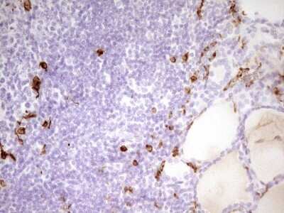 Immunohistochemistry: APOB48R Antibody (OTI1B1) [NBP2-46532] - Analysis of Human thyroid tissue. (Heat-induced epitope retrieval by 1 mM EDTA in 10mM Tris, pH8.5, 120C for 3min)