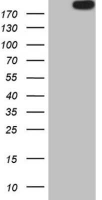 Western Blot APOB48R Antibody (OTI1B1)