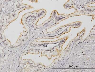 Immunohistochemistry-Paraffin: APOB48R Antibody (2D7) [H00055911-M03] - Analysis of monoclonal antibody to APOB48R on formalin-fixed paraffin-embedded human prostate. Antibody concentration 1.5 ug/ml