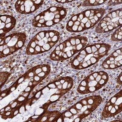 Immunohistochemistry: APOB48R Antibody [NBP1-90129] - Staining of human rectum shows strong cytoplasmic positivity in glandular cells and peripheral leukocytes.