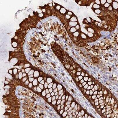 Immunohistochemistry: APOB48R Antibody [NBP1-90130] - Staining of human colon shows strong cytoplasmic positivity in glandular cells.