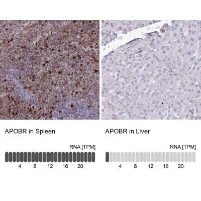 <b>Orthogonal Strategies Validation. </b>Immunohistochemistry-Paraffin: APOB48R Antibody [NBP1-90129] - Staining in human spleen and liver tissues using anti-APOBR antibody. Corresponding APOBR RNA-seq data are presented for the same tissues.