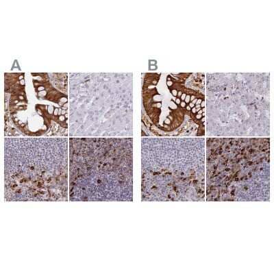 <b>Independent Antibodies Validation. </b>Immunohistochemistry-Paraffin: APOB48R Antibody [NBP1-90129] - Staining of human colon, liver, lymph node and spleen using Anti-APOBR antibody NBP1-90129 (A) shows similar protein distribution across tissues to independent antibody NBP1-90130 (B).