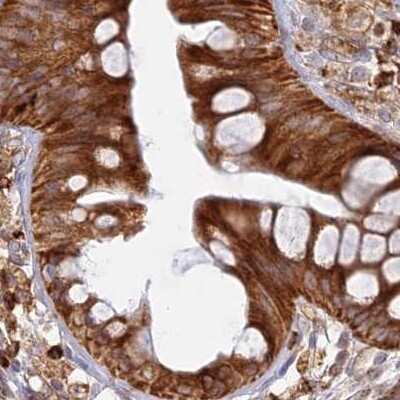 Immunohistochemistry-Paraffin: APOB48R Antibody [NBP1-90129] - Staining of human colon.