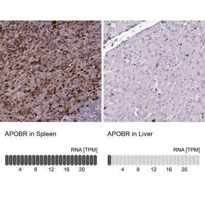 <b>Orthogonal Strategies Validation. </b>Immunohistochemistry-Paraffin: APOB48R Antibody [NBP1-90130] - Staining in human spleen and liver tissues using anti-APOBR antibody. Corresponding APOBR RNA-seq data are presented for the same tissues.