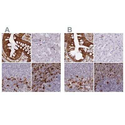 <b>Independent Antibodies Validation. </b>Immunohistochemistry-Paraffin: APOB48R Antibody [NBP1-90130] - Staining of human colon, liver, lymph node and spleen using Anti-APOBR antibody NBP1-90130 (A) shows similar protein distribution across tissues to independent antibody NBP1-90129 (B).