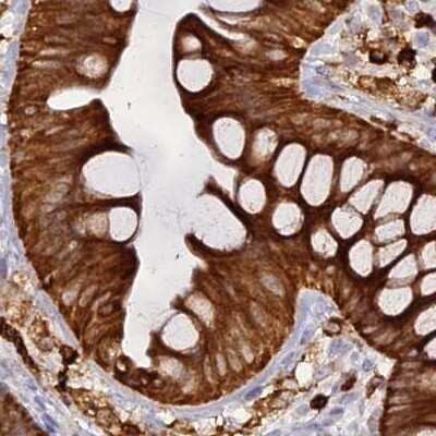 Immunohistochemistry-Paraffin: APOB48R Antibody [NBP1-90130] - Staining of human colon.