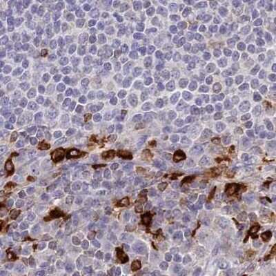 Immunohistochemistry-Paraffin: APOB48R Antibody [NBP1-90130] - Staining of human lymph node.