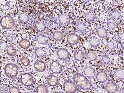 Immunohistochemistry-Paraffin: APOB48R Antibody [NBP2-98580] - Staining of human APOB48R in human large intestine with rabbit polyclonal antibody at 1:500 dilution.