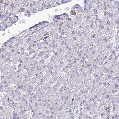 Western Blot: APOB48R Antibody [NBP1-90129] - Staining of human liver shows low expression as expected.