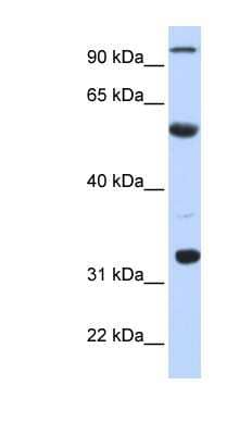 Western Blot: APOBEC1 Antibody [NBP1-57268] - Titration: 0.2-1 ug/ml, Positive Control: Human Liver.