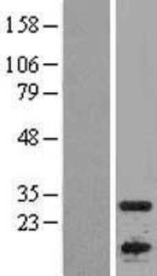 Western Blot: APOBEC1 Overexpression Lysate (Adult Normal) [NBL1-07612] Left-Empty vector transfected control cell lysate (HEK293 cell lysate); Right -Over-expression Lysate for APOBEC1.