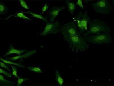 Immunocytochemistry/Immunofluorescence: APOBEC2 Antibody [H00010930-B01P] - Analysis of purified antibody to APOBEC2 on HeLa cell. (antibody concentration 10 ug/ml)