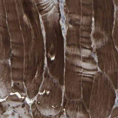 Immunohistochemistry: APOBEC2 Antibody [NBP1-88849] - Staining of human skeletal muscle shows strong cytoplasmic positivity in myocytes.