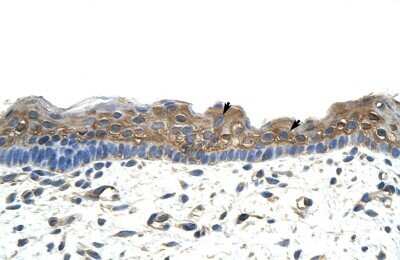 Immunohistochemistry-Paraffin: APOBEC2 Antibody [NBP1-57469] - Human Skin Tissue Squamous epithelial cells (Indicated with Arrows), 4-8ug/ml.