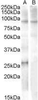 Western Blot: APOBEC2 Antibody [NB100-93372] - (1ug/ml) staining of Human Heart lysate (35ug protein in RIPA buffer) with (B) and without (A) blocking with the immunising peptide. Primary incubation was 1 hour. Detected by chemiluminescence.