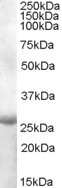 Western Blot: APOBEC2 Antibody [NB100-93451] - (1ug/ml) staining of Human Muscle lysate (35ug protein in RIPA buffer). Primary incubation was 1 hour. Detected by chemiluminescence.