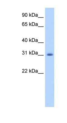 Western Blot: APOBEC2 Antibody [NBP1-57469] - Titration: 1.25ug/ml, Positive Control: Human Muscle.