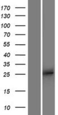 Western Blot: APOBEC2 Overexpression Lysate (Adult Normal) [NBP2-07578] Left-Empty vector transfected control cell lysate (HEK293 cell lysate); Right -Over-expression Lysate for APOBEC2.