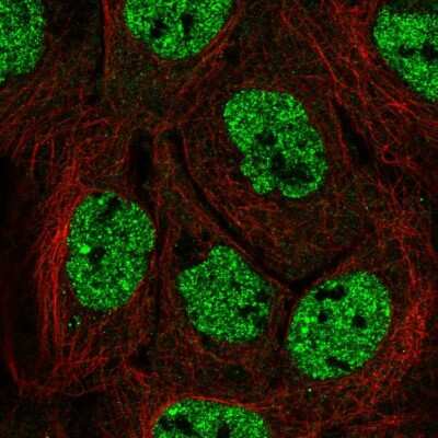 Immunocytochemistry/Immunofluorescence: APOBEC3B Antibody [NBP2-56411] - Staining of human cell line A-431 shows localization to nucleoplasm. Antibody staining is shown in green.