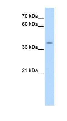 Western Blot: APOBEC3B Antibody [NBP1-57516] - HepG2 cell lysate, concentration 0.2-1 ug/ml.