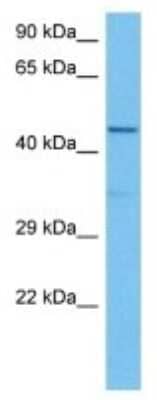 Western Blot: APOBEC3B Antibody [NBP3-10834] - Western blot analysis of APOBEC3B in Mouse Heart lysates. Antibody dilution at 1ug/ml