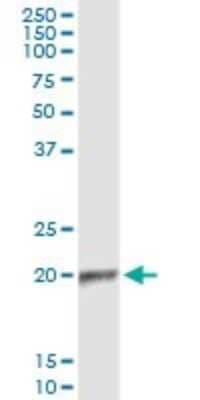 Immunoprecipitation: APOBEC3C Antibody (3E6) [H00027350-M01] - Analysis of APOBEC3C transfected lysate using anti-APOBEC3C monoclonal antibody and Protein A Magnetic Bead, and immunoblotted with APOBEC3C MaxPab rabbit polyclonal antibody.