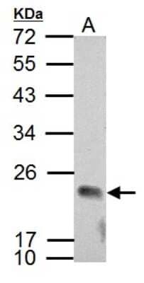 Western Blot: APOBEC3C Antibody [NBP2-14875] - Sample (30 ug of whole cell lysate) A: NCI-H929 12% SDS PAGE, antibody diluted at 1:2000.