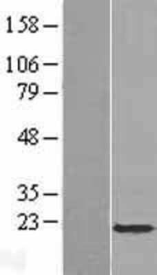 Western Blot: APOBEC3C Overexpression Lysate (Adult Normal) [NBP2-07320] Left-Empty vector transfected control cell lysate (HEK293 cell lysate); Right -Over-expression Lysate for APOBEC3C.