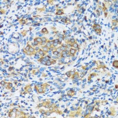 Immunohistochemistry-Paraffin: APOBEC3F Antibody [NBP2-92770] - Rat ovary using APOBEC3F antibody at dilution of 1:100 (40x lens).Perform microwave antigen retrieval with 10 mM PBS buffer pH 7.2 before commencing with IHC staining protocol.