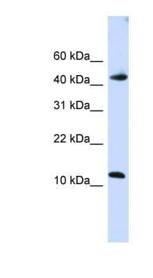 Western Blot: APOBEC3F Antibody [NBP1-57515] - Human Brain lysate, concentration 0.2-1 ug/ml.