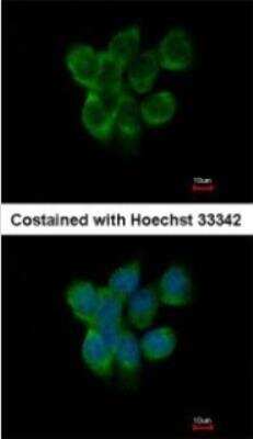 Immunocytochemistry/Immunofluorescence: APOBEC3G Antibody [NBP2-53089] - Paraformaldehyde-fixed A431, using antibody at 1:500 dilution.