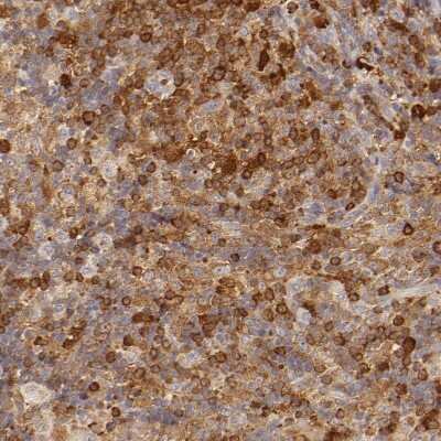 Immunohistochemistry-Paraffin: APOBEC3G Antibody [NBP1-88592] - Staining of human lymph node shows moderate to strong cytoplasmic positivity in lymphoid cells.