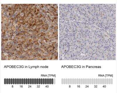 Immunohistochemistry-Paraffin: APOBEC3G Antibody [NBP1-88592] - Analysis in human lymph node and pancreas tissues.  Corresponding APOBEC3G RNA-seq data are presented for the same tissues.