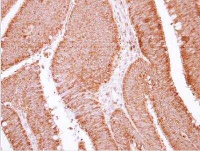 Immunohistochemistry-Paraffin: APOBEC3G Antibody [NBP2-53089] - Paraffin-embedded Colon, using antibody at 1:250 dilution.