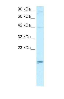 Western Blot: APOBEC3G Antibody [NBP1-58955] - Daudi cell lysate, Antibody Titration: 0.2-1 ug/ml