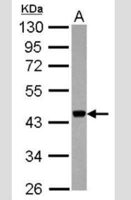 Western Blot: APOBEC3G Antibody [NBP2-53089] - Sample (30 ug of whole cell lysate) A: Jurkat 10% SDS PAGE; antibody diluted at 1:1000.