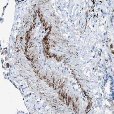 Immunohistochemistry APOBEC4 Antibody - BSA Free