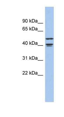 Western Blot: APOBEC4 Antibody [NBP1-56377] - Human Brain lysate, concentration 0.2-1 ug/ml.