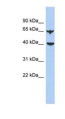 Western Blot: APOBEC4 Antibody [NBP1-56380] - Human Lung lysate, concentration 0.2-1 ug/ml.