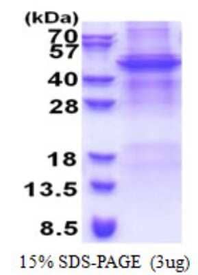 SDS-PAGE Recombinant Human APOBEC4 His Protein
