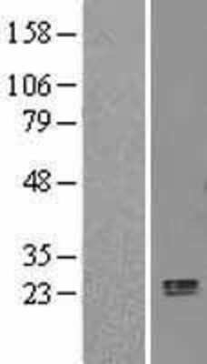 Western Blot: APOL3 Overexpression Lysate (Adult Normal) [NBP2-05481] Left-Empty vector transfected control cell lysate (HEK293 cell lysate); Right -Over-expression Lysate for APOL3.