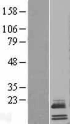 Western Blot: APOO Overexpression Lysate (Adult Normal) [NBL1-07630] Left-Empty vector transfected control cell lysate (HEK293 cell lysate); Right -Over-expression Lysate for APOO.
