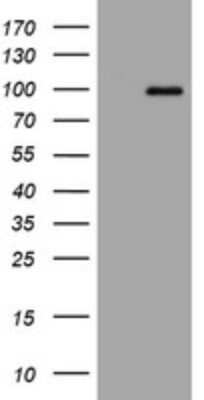 Western Blot: APP Antibody (4C9) [NBP2-46535] - Analysis of HEK293T cells were transfected with the pCMV6-ENTRY control (Left lane) or pCMV6-ENTRY APP.