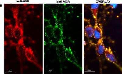 Immunocytochemistry/Immunofluorescence: APP Antibody [NB300-308] - Cell surface staining of VDR (green) on live neurons followed by fixation and immunofluorescence labeling of target protein (100x) APP. Overlay images indicate the possible co-localization of VDR/APP on the neuronal plasma membrane. Image collected and cropped by CiteAb from the following publication (//journals.plos.org/plosone/article?id=10.1371/journal.pone.0188605) licensed under a CC-BY license. 