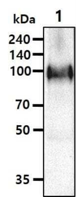 Western Blot: APP Antibody (J4H9) [NBP1-04263] - The lysate(40ug) was resolved by SDS-PAGE, transferred to PVDF membrane and probed with anti-human APP (1:1000). Proteins were visualized using a goat anti-mouse secondary antibody conjugated to HRP and an ECL detection system.Lane 1.: Mouse brain tissue lysate.