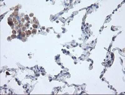 Immunohistochemistry: APP Antibody (OTI4C9) - Azide and BSA Free [NBP2-70197] - Analysis of Human lung tissue.